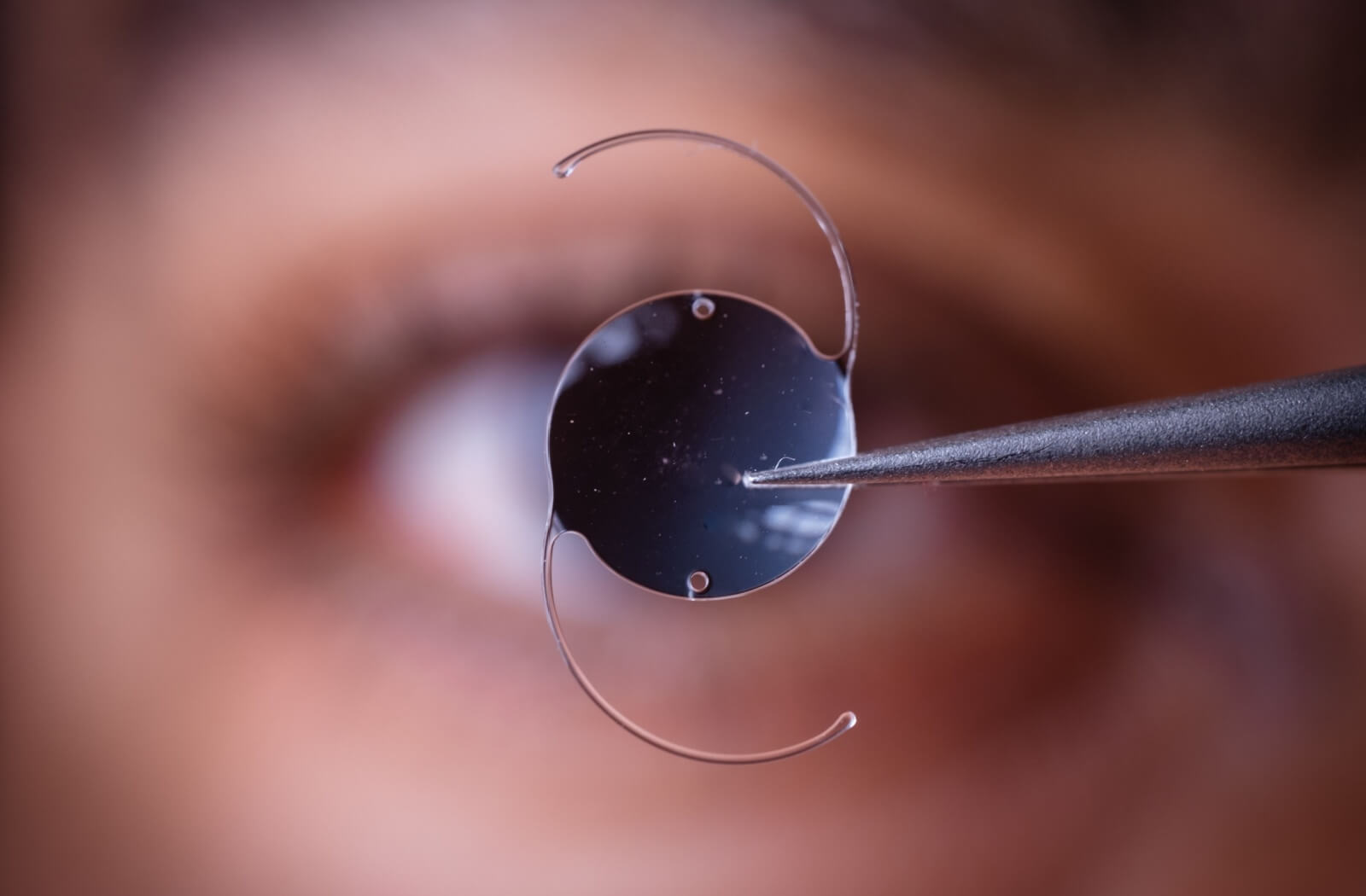 Best Cataract Centre in Jaipur